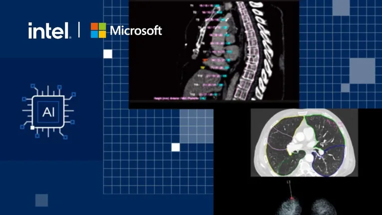 Reduciendo la Brecha en Radiología: